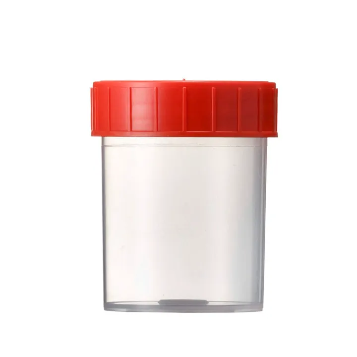 Probenbehälter aus PP, 125 ml mit Schraubdeckel rot 380 St./Packung 00441029
